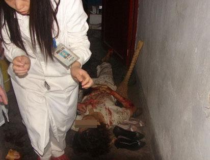 Ѫ�Ȍ��ģ�����Ů�Ӛ�����Ԛ��F��(�M�D)