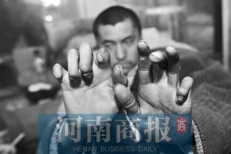 男子被騙進(jìn)黑磚窯遭虐待 扒火車凍掉腳趾(圖)