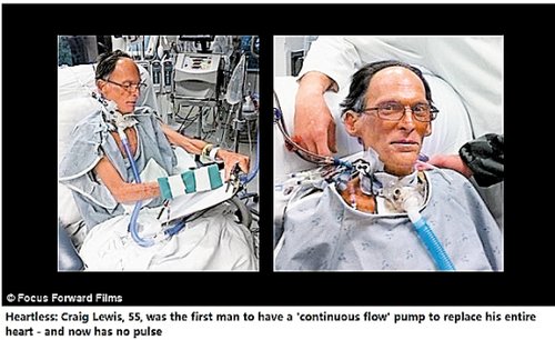 ����˹�������g