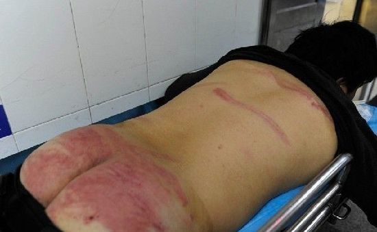 ����С؜���ǹܱ��� ��(sh��)�˷Q�䱻���ψ�(zh��)��܇(ch��)(�D)