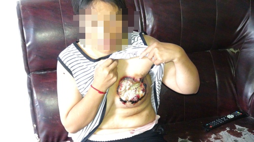 楊九蘭的病情日益加重